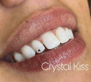 Crystal Kiss